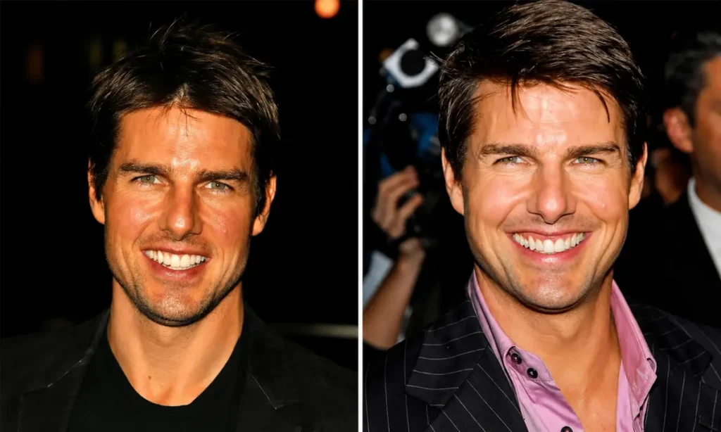 tom cruise middle tooth