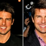 tom cruise middle tooth